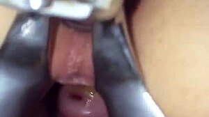 My personal experience with female anal injections