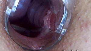 Speculum babe anally fingered in erotic couple play