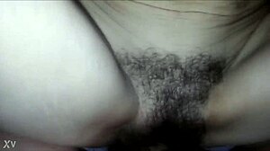 Chatting casually about a hairy situation