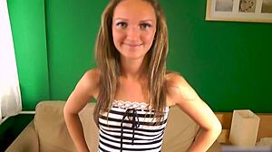 Teen takes massive facial